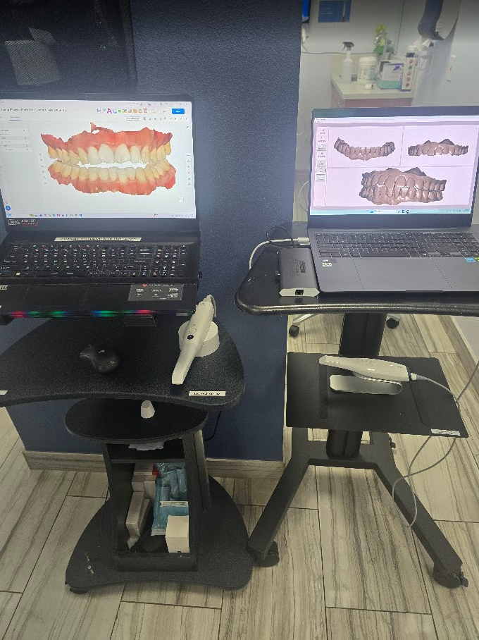 Intraoral scanners with digital dental models displayed on monitors